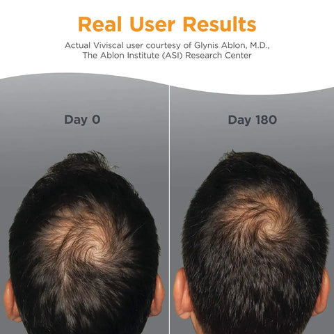 Men's Hair Growth Supplement
